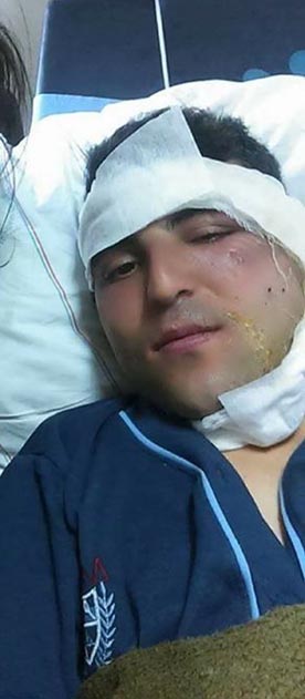Vezirköprü’lü polis Ali Yüksel yaralandı